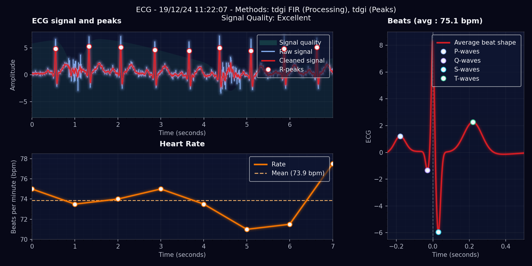 Screenshot ECG analysis